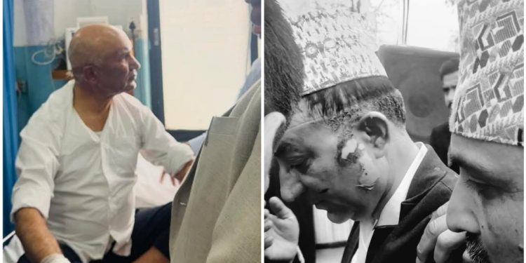 अर्थमन्त्री पौडेल र मेयर आचार्यको उपचार हुँदै