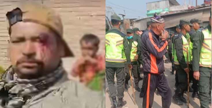 टेकुको कबाडी गोदाममा डोजर, नगर प्रहरीको कुटाइबाट ३ मजदुर घाइते