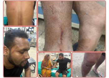 यादबले गाउँमा बस्न नदिने धम्की दिदैं पत्रकार रामलाई गरे कुटपिट