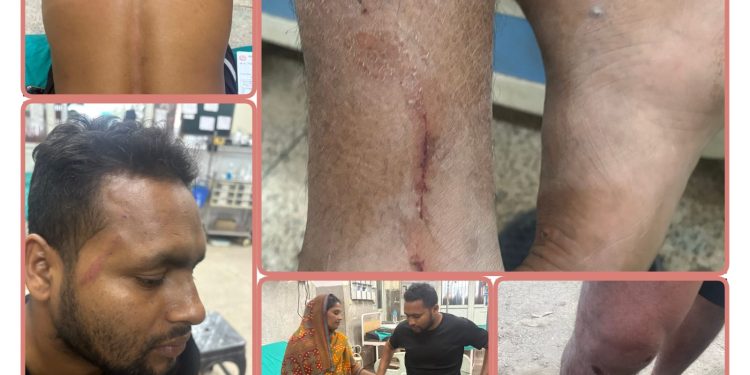 यादबले गाउँमा बस्न नदिने धम्की दिदैं पत्रकार रामलाई गरे कुटपिट