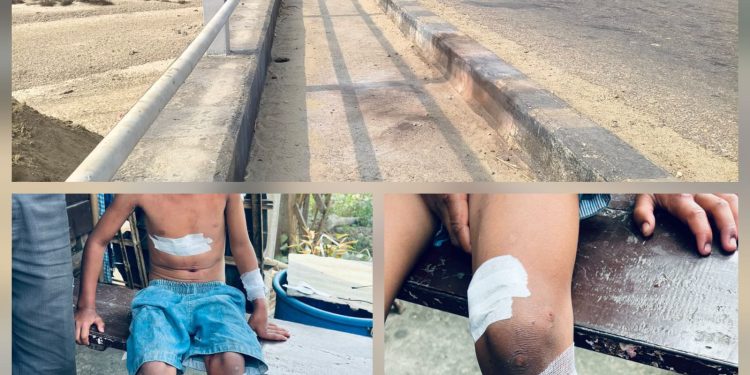 धनुषामा शंकास्पद वस्तु विस्फोट, तीन बालबालिका घाइते