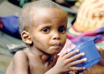 कृषिमा सम्पन्न प्रदेशमै उच्च बाल कुपोषण, सरकार चिन्तित