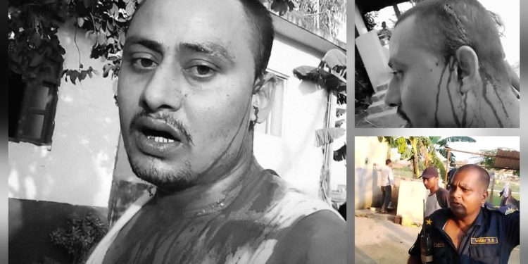 रगताम्य अवस्थामा प्रहरी चौकी पुगेका विजयको गुनासो : ‘हाम्रो सहारा कोही छैन’