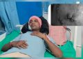 मिथिला बिहारी-७ मा होटल सञ्चालक पुनेप्रताप साहमाथि आक्रमण